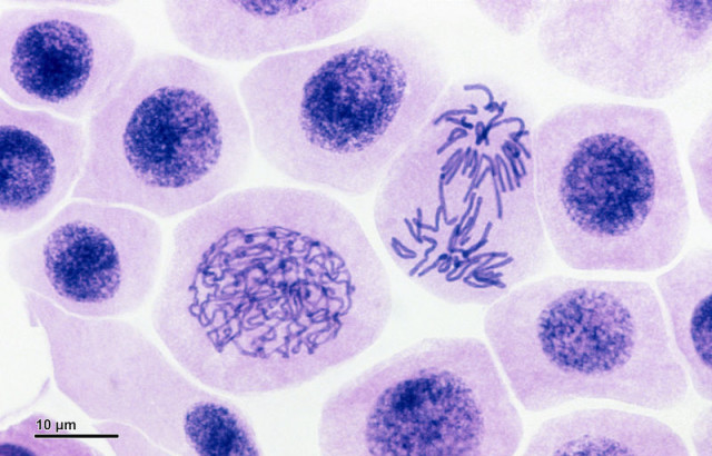 mitosis stages under microscope